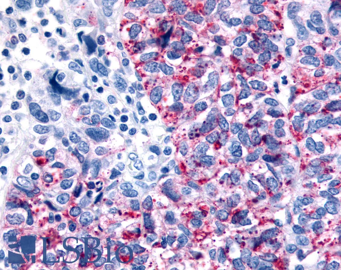 PathPlus™ GPR35 Antibody (C-Terminus)