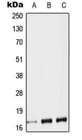 Polyclonal Rabbit anti-Human TAC1 Antibody (Internal, WB)