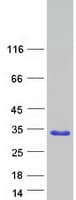 Human FAM89B Protein (Recombinant Myc-DDK (Flag))