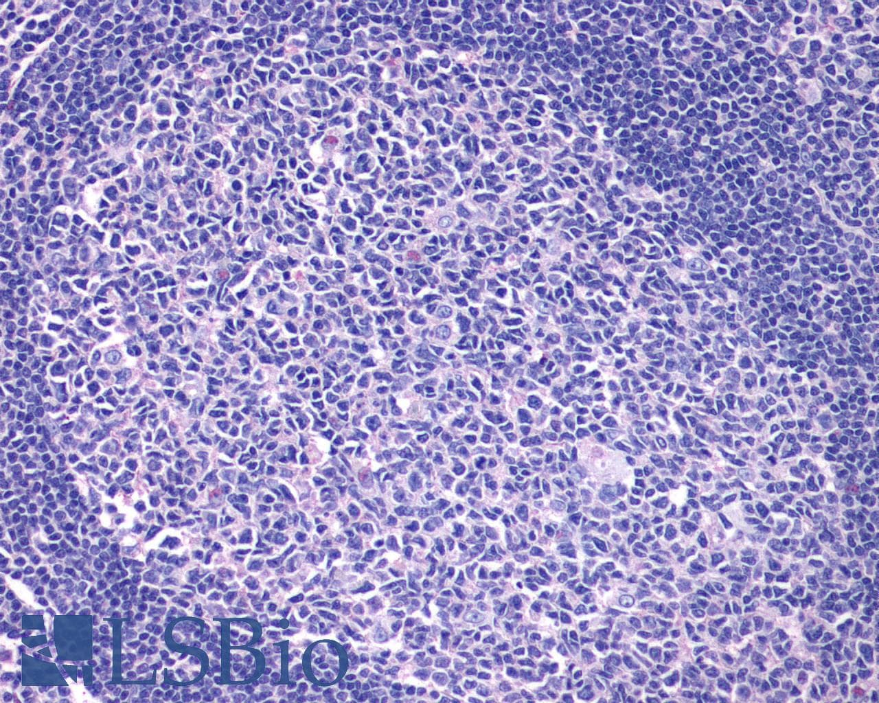 IHC-plus™ Polyclonal Rabbit anti-Human FFAR2 / GPR43 Antibody (Cytoplasmic Domain, IHC)