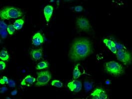 Monoclonal Mouse anti-Human LOX / Lysyl Oxidase Antibody (clone OTI5C4, IHC, IF, WB)