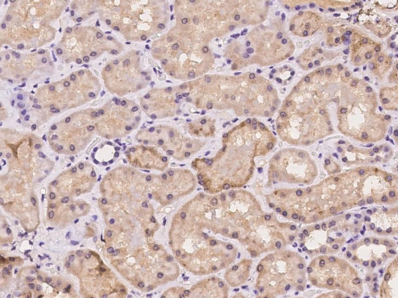 Polyclonal Rabbit anti-Human PPM1A / PP2CA Antibody (IHC)