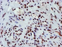 GSTT2 Antibody (clone OTI3B6)