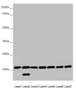 DCTN6 / Dynactin 6 Antibody