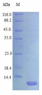 Mouse CCL17 / TARC Protein (Recombinant)