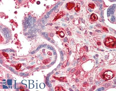 IHC-plus™ G6PD Antibody (aa50-100)