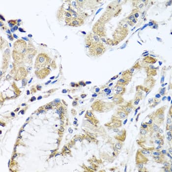 IL28B Antibody