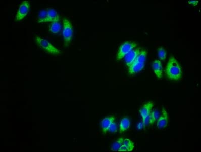 ALK3 / BMPR1A Antibody (aa177-532)