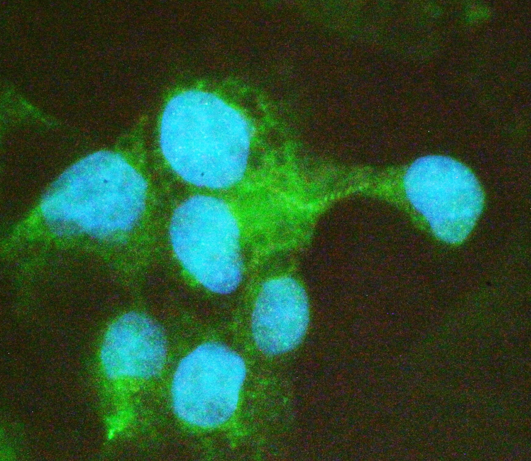 COMP / THBS5 Antibody