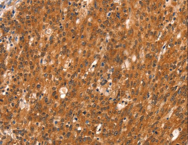 DAB2IP Antibody