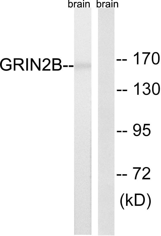 GRIN2B / NMDAR2B / NR2B Antibody (p1303)