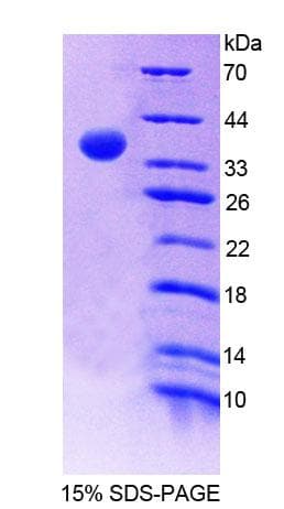 Mouse RNASEH2A Protein (Recombinant His-T7, N-terminus)