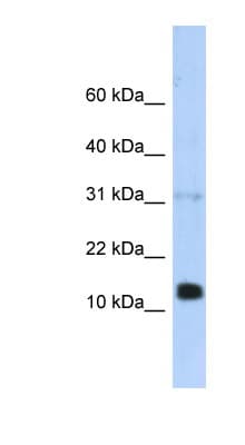 REG1B Antibody (N-Terminus)