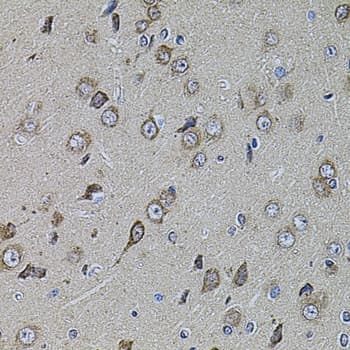 Polyclonal Rabbit anti-Human UQCRC1 Antibody (IHC, WB)