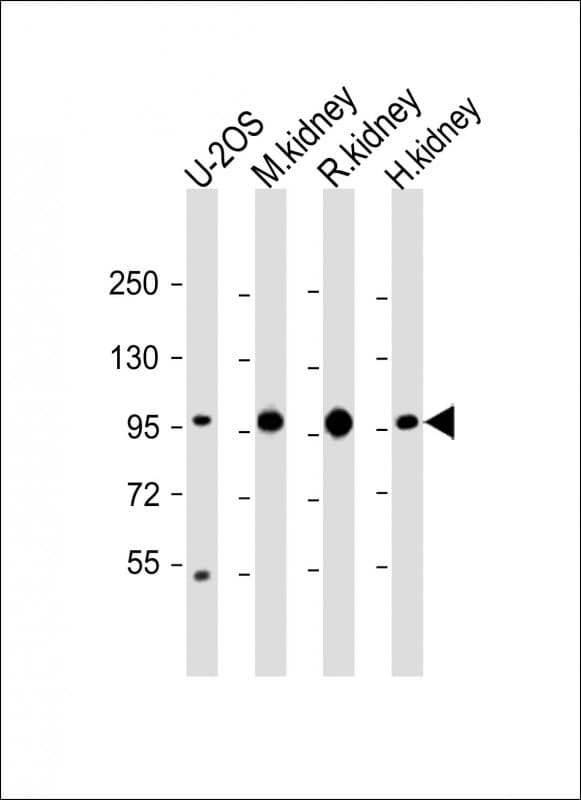 ACO1 / Aconitase Antibody (N-Terminus)