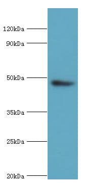 ACTR3B / ARP4 Antibody (aa189-418)
