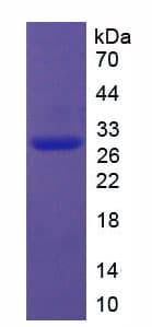 Mouse SIRT1 / Sirtuin 1 Protein (Recombinant His)