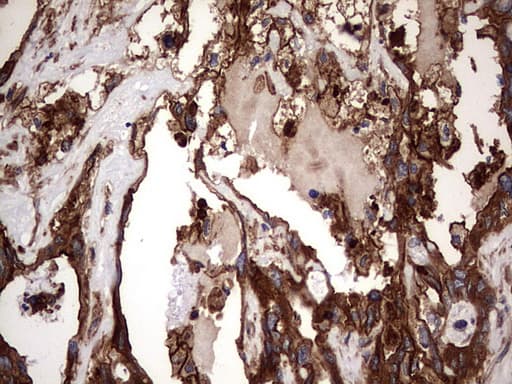 KRT7 / CK7 / Cytokeratin 7 Antibody (clone OTI2A2)