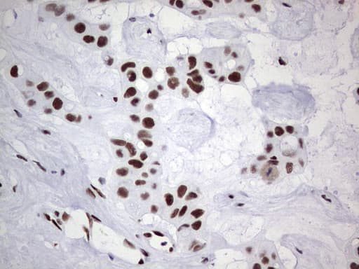 Monoclonal Mouse anti-Human PPP1R8 / Rnase E Antibody (clone OTI4E5, aa1-225, IHC, WB)