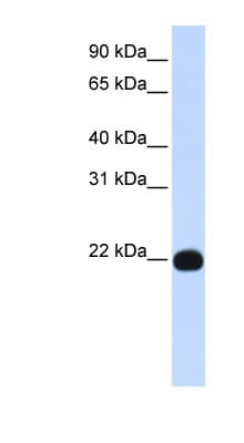 GPI3 / PIGA Antibody (aa117-166)