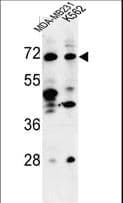 Polyclonal Rabbit anti-Human TSPEAR Antibody (aa293-320, IHC, WB)