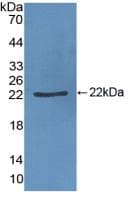 VWF / Von Willebrand Factor Antibody (aa1167-1334, PE)