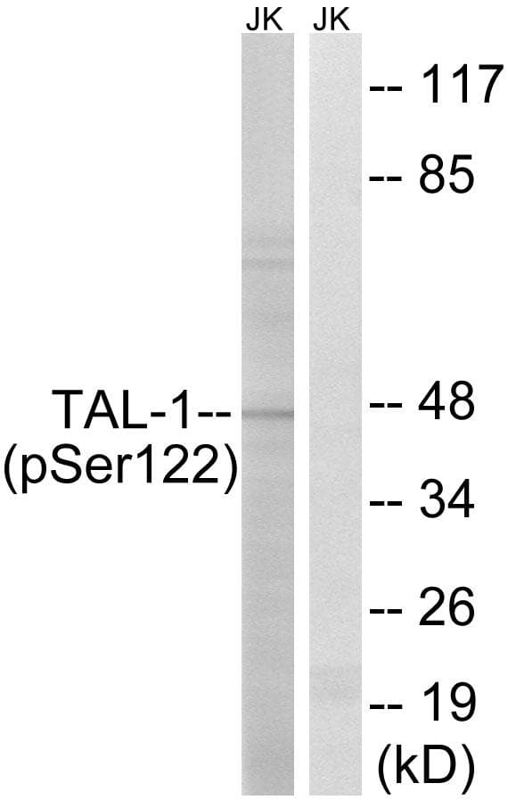 TAL1 Antibody (phospho-Ser122)