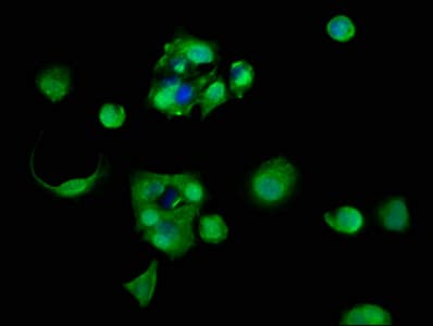Polyclonal Rabbit anti-Human RPL11 / Ribosomal Protein L11 Antibody (IHC, IF)