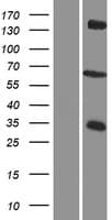 ZDHHC12 Protein (Over-Expression Lysate Myc-DDK (Flag))