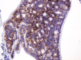 CA12 / Carbonic Anhydrase XII Antibody (clone OTI1A6)