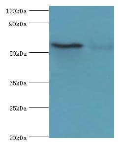 Polyclonal Rabbit anti-Human CSTF2 / CstF-64 Antibody (aa1-180, IHC, WB)