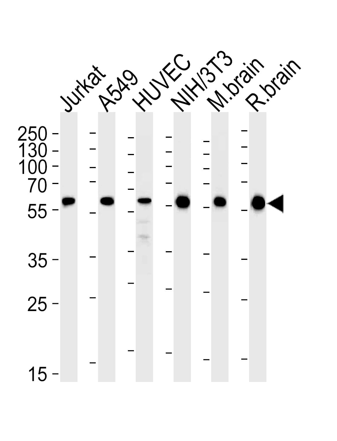 RAD23B / HR23B Antibody (aa1-409, clone 1228CT409.120.123.135)