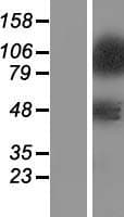 ZNF281 / Zfp281 Protein (Over-Expression Lysate Myc-DDK (Flag))