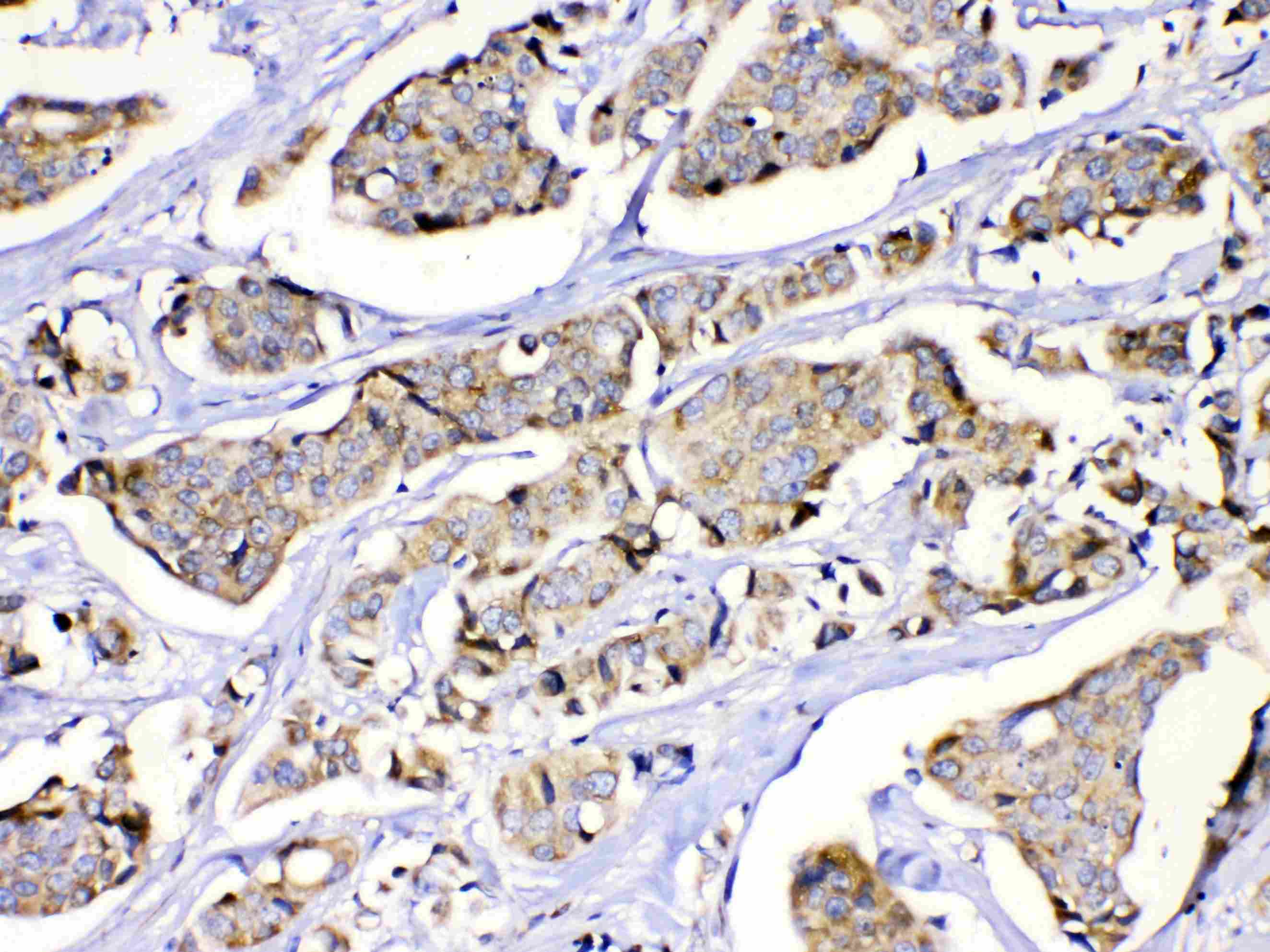 MUT / MCM Antibody
