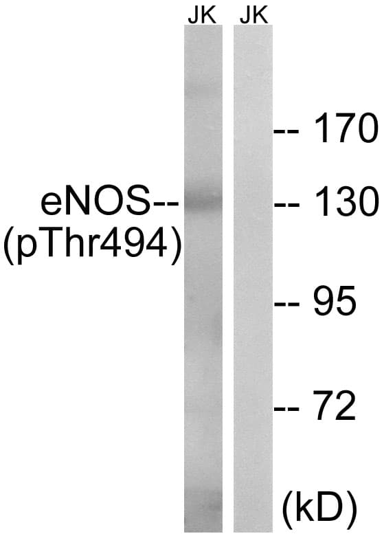 NOS3 / eNOS Antibody (phospho-Thr494)