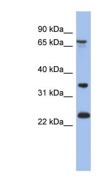 Polyclonal Rabbit anti-Human TBC1D25 Antibody (aa179-228, WB)
