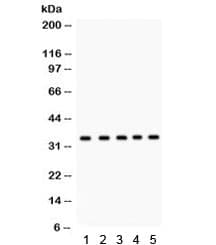 EBAG9 / RCAS1 Antibody