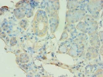 Polyclonal Rabbit anti-Human ATG9B Antibody (aa715-924, IHC)