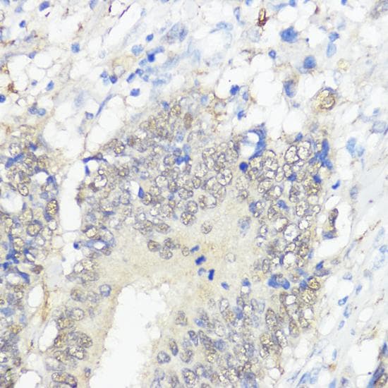 Polyclonal Rabbit anti-Human GPX2 Antibody (IHC)