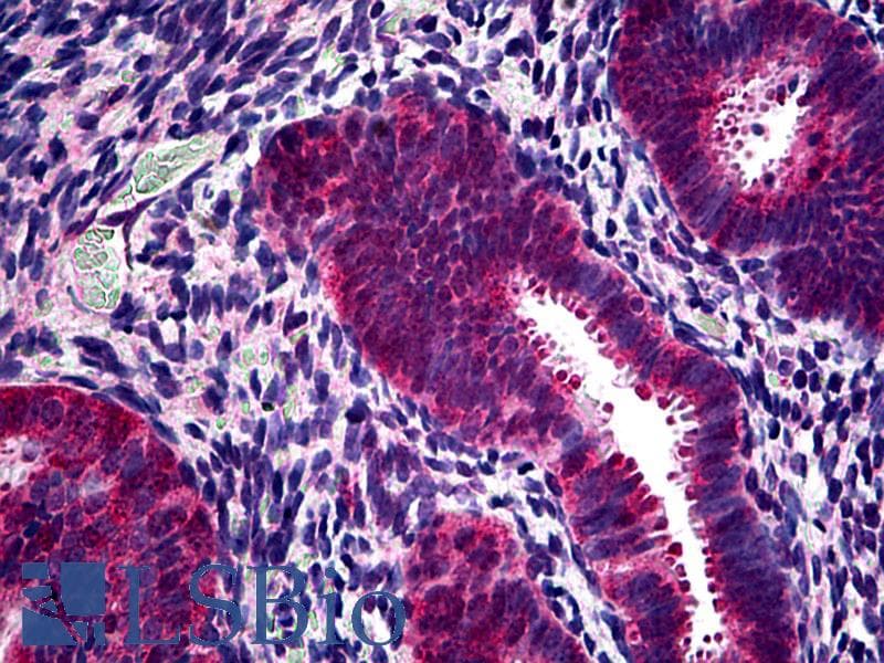 IHC-plus™ PHPT1 Antibody (aa1-30)