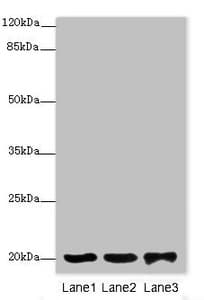 Polyclonal Rabbit anti-Human FAIM Antibody (WB)