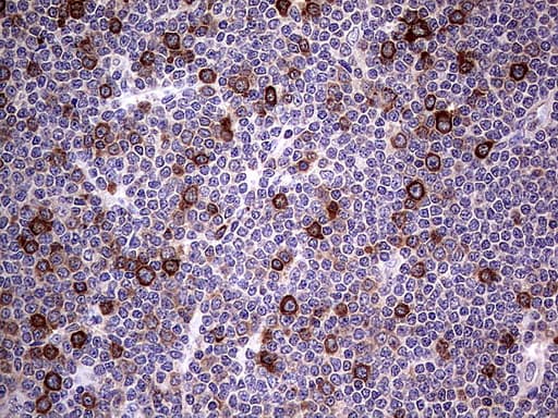 R1 / RRM1 Antibody (aa541-792, clone UMAB165, Carrier-free)