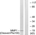MMP1 Antibody (aa81-130)