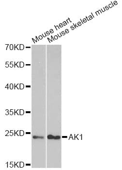Polyclonal Rabbit anti-Human AK1 / Adenylate Kinase 1 Antibody (IHC, IF, WB)