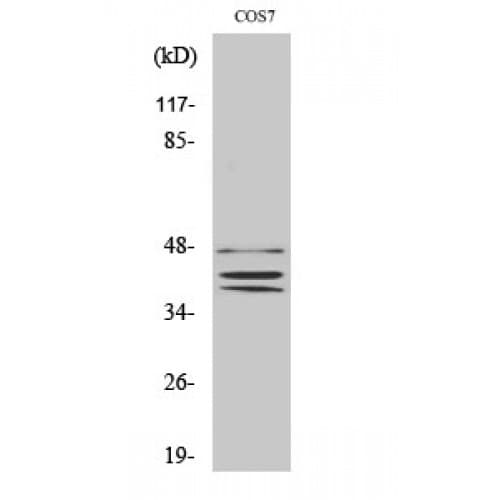 Polyclonal Rabbit anti-Human Sox8+9+17+18 Antibody (90-170 aa, Internal, IHC, WB)