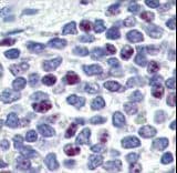 KLF4 Antibody (aa69-101)