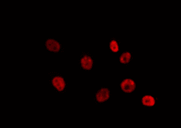 Polyclonal Rabbit anti-Human SUV39H2 Antibody (IF, WB)