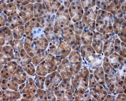 TLDC1 / KIAA1609 Antibody (clone OTI3C4, Carrier-free)