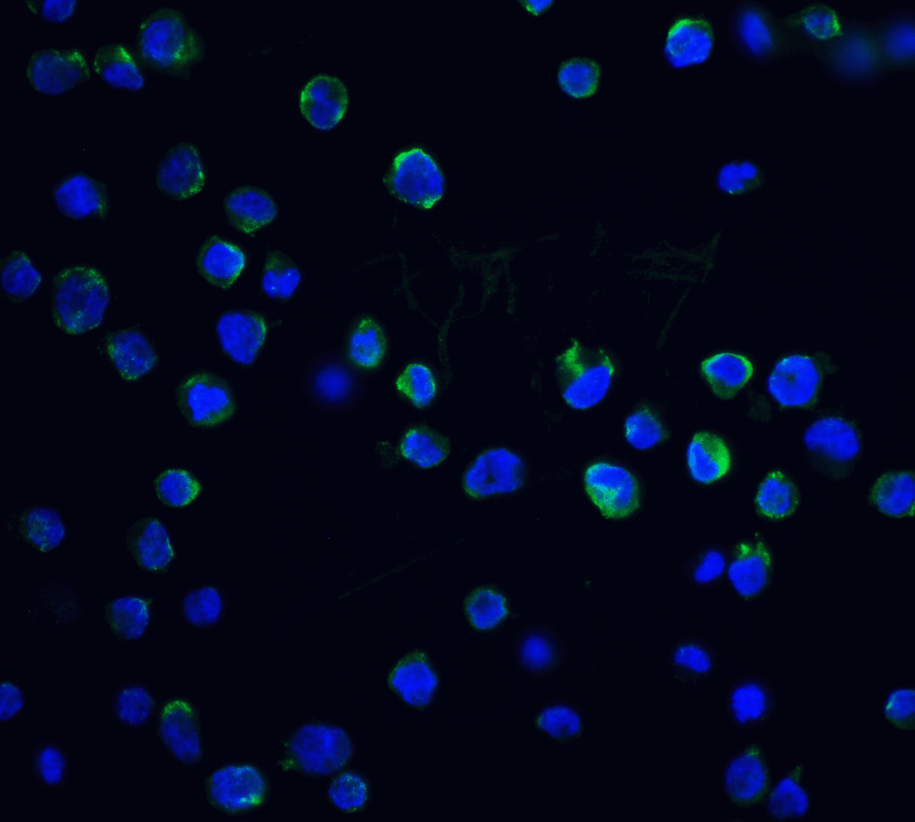 IHC-plus™ Polyclonal Rabbit anti-Human DFFB Antibody (IHC, IF, WB)