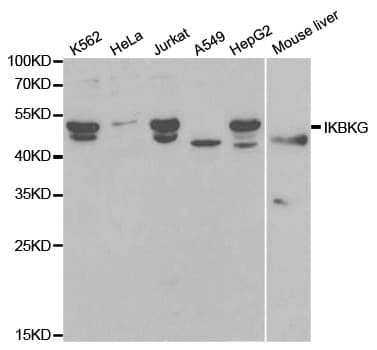 IKBKG / NEMO / IKK Gamma Antibody
